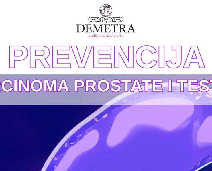 Prevencija karcinoma prostate i testisa • Demetra Lab